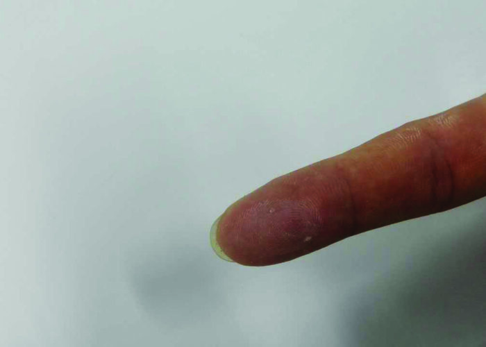 Fig.6_Tedlar